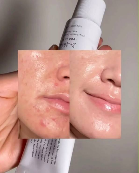 کرم ترمیم کننده و ضد التهاب 345دکتر آلتیا DR.Altia 345 relife cream 50ml - تصویر 2